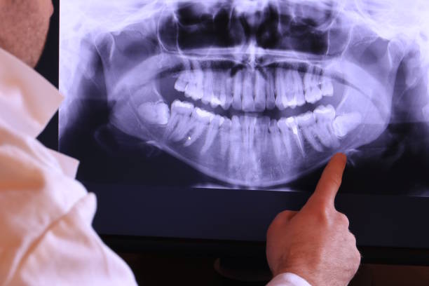 Best Mobile Emergency Dentist in Cedar Springs, MI