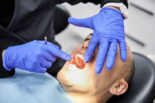 Best Emergency Dental Extractions in Cedar Springs, MI