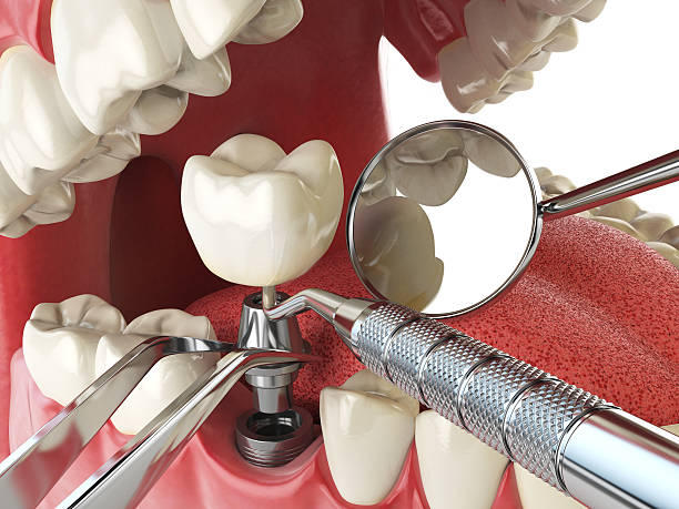 Best Mobile Emergency Dentist in Cedar Springs, MI